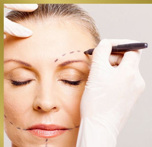 blefaroplastia